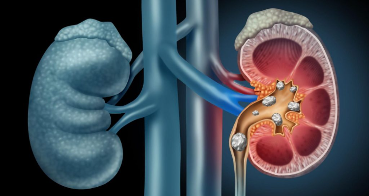 Urologist Singapore Mount Elizabeth